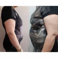 لاغری|خدمات زیبایی و سلامت|شیراز, حومه شیراز|دیوار