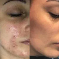 جشنواره ویژه تخصصی فیشال ففط فقط تا اول مهرماه|خدمات آرایشگری و زیبایی|تهران, مدائن|دیوار