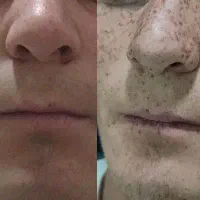 حذف دائمی کک و مک با تخفیفات ویژه بلک فرایدی