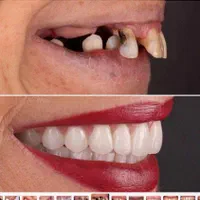 دستیار دندانپزشک|استخدام درمانی، زیبایی، بهداشتی|تهران, شهرک ولیعصر جنوبی|دیوار