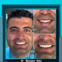 دندانپزشکی زیبایی و درمانی لمینت کامپوزیت دندان|خدمات آرایشگری و زیبایی|شیراز, معالی‌آباد|دیوار