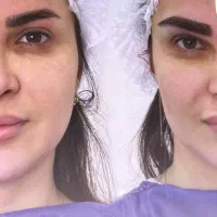 مدل کاشت ابرو جهت تولید محتوا
