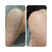 کفسابی vipخیس وپارافین تراپی پابه مدت۱۰ روزفقط ۴۰۰|خدمات آرایشگری و زیبایی|اصفهان, برازنده|دیوار