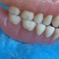نیازمند دندانپزشک جهت همکاری واخذ مجوز مطب
