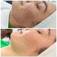 آموزش،فیشیال،پاکسازی تخصصی،جوانسازی صورت بانوان|خدمات آرایشگری و زیبایی|کرمانشاه, |دیوار