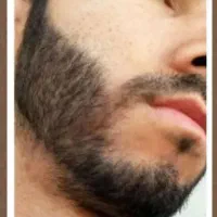 ریش پرپشت در یک ماه