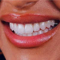 ایمپلنت دیجیتال/کامپوزیت/ لمینت/خدمات دندانپرشکی|خدمات آرایشگری و زیبایی|تهران, فردوس|دیوار
