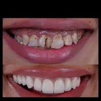 دندانپزشکی اقساطی(ارتودنسی×کامپوزیت×ایمپلنت)دندان|خدمات آرایشگری و زیبایی|مشهد, طلاب|دیوار