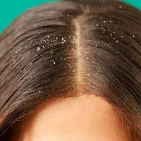 پک ضد شوره ام ان دی|آرایشی، بهداشتی، درمانی|بومهن, |دیوار