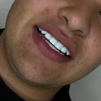 کامپوزیت آف ویژه