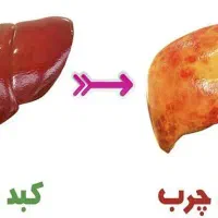 پکیج کبد چرب بهبود چربی کبد