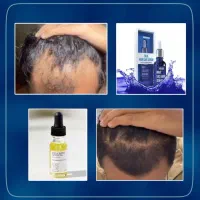 راهکار تخصصی برای رشد و بازسازی کامل مو