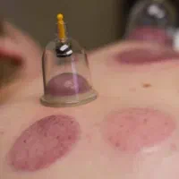 کارگاه آموزشی حجامت،زالودرمانی وبادکش|خدمات آموزشی|تهران, میدان ولیعصر|دیوار