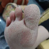کف سابی پا خانمهاواقایان