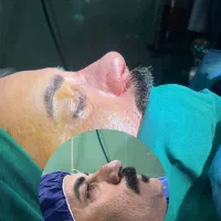 ظرفیت خالی عمل بینی  با ۲۲میلیون با متخصص بینی|خدمات آرایشگری و زیبایی|تهران, جمال‌زاده|دیوار
