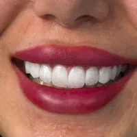 خدمات فوق تخصصی  دندانپزشکی کلینیک پالادیوم|خدمات آرایشگری و زیبایی|شیراز, معالی‌آباد|دیوار