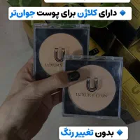 پنکک/فرانسوی/ نمایندگی اصلی/ ضمانت اصالت/درگز