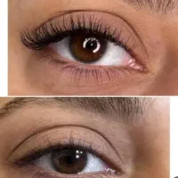 اصلاح درماپلینگ همراه پاکسازی و کاشت مژه