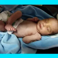 اجاره دستگاه زردی نوزاد غرب تهران و تهرانسر