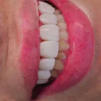 خدمات دندانپزشکی