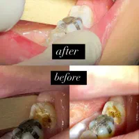 دندانپزشکی بزرگسال و اطفال|خدمات آرایشگری و زیبایی|لاهیجان, شیخ زاهد|دیوار