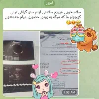 بارداری|آرایشی، بهداشتی، درمانی|اردبیل, |دیوار