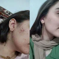 کرم اکسیر جوانی با روغن کاملا طبیعی|آرایشی، بهداشتی، درمانی|دهدشت, |دیوار