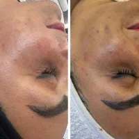 فشیال تخصصی و‌ آموزش با نتایج تضمینی