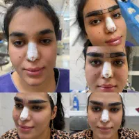 تخفیف میکرو کاشت ابرو تخصصی وکاشت مو|خدمات زیبایی و سلامت|شیراز, میرزاکوچک خان|دیوار