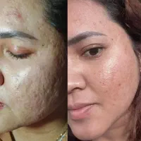 برای زیبایت ارزش قائل باش محصول اصل بزن