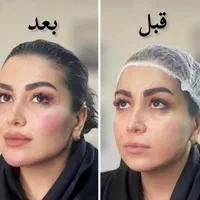 تخفیفات۵۰ درصدی ژل،بوتاکس،انزیم کیلینیک هستی|خدمات آرایشگری و زیبایی|کرمانشاه, |دیوار
