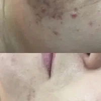 فیشال تخصصی درمانی در کلینیک زیبایی صبا|خدمات آرایشگری و زیبایی|تهران, عباس‌آباد|دیوار