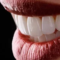 دندانپزشکی اقساطی عصب کشی . کامپوزیت و...|خدمات آرایشگری و زیبایی|قم, عمار یاسر|دیوار