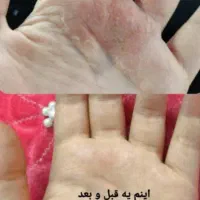 نمایندگی روغنهای درمانی وخوراکی|آرایشی، بهداشتی، درمانی|فریمان, |دیوار