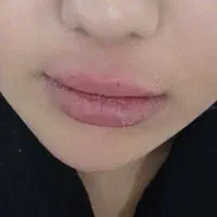 تزریق ژل و بوتاکس بصورت نقد و اقساط|خدمات آرایشگری و زیبایی|فولادشهر, ورزشگاه فولادشهر|دیوار