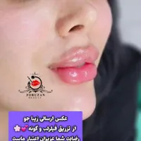 آفر(۷ روزه) ژل و بوتاکس فولادشهر|خدمات آرایشگری و زیبایی|فولادشهر, فولادشهر|دیوار