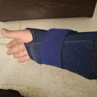 مچ بند در حدنو (اسلامشهرم)