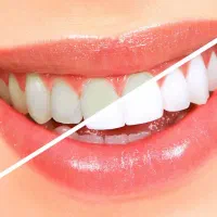 کلینیک تخصصی زیبایی و درمانی دندان|خدمات آرایشگری و زیبایی|کرمانشاه, |دیوار