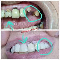 کامپوزیت دندان ژل و بوتاکس پی آرپی و لیفت نخ|خدمات آرایشگری و زیبایی|اهواز, نادری|دیوار
