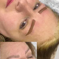 احیای تتوهای تیره و قدیمی با رنگ روشن بدون ریمو