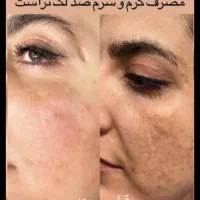 محصولات تراست بامشاوره رایگان برای شما عزیزان|آرایشی، بهداشتی، درمانی|سنقر, |دیوار