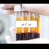 درمان آرتروز زانو/به روش پلاسما|خدمات آرایشگری و زیبایی|خرم‌آباد, |دیوار