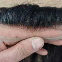 پروتز مو|خدمات آرایشگری و زیبایی|فردیس, طالقانی|دیوار