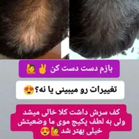 روغن مو معجزه‌گر