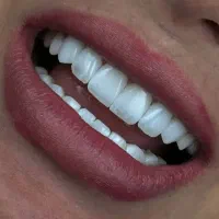 ارائه کلیه خدمات دندانپزشکی