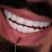 خدمات فوق تخصصی  دندانپزشکی کلینیک پالادیوم|خدمات آرایشگری و زیبایی|شیراز, معالی‌آباد|دیوار