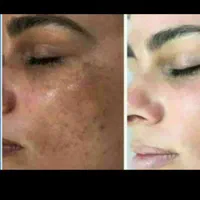 کرم معجزه صابون صندل ۱۲۵گرمی|آرایشی، بهداشتی، درمانی|ورامین, ورامین|دیوار