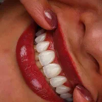 دندان پزشکی هلال با تعرفه‌های دولتی|خدمات آرایشگری و زیبایی|اهواز, اهواز|دیوار