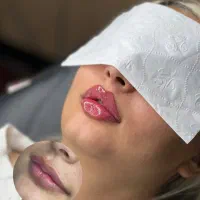 جوانسازی تخصصی صورت با قیمت مناسب