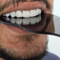 خدمات دندانپزشکی،عصب کشی،ترمیم،زیبایی